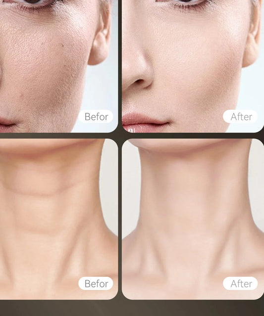Rechargeable Hello Face Red Light Face & Neck Mask